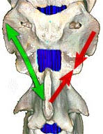 The caudal muscles causing the rotation,
and the sensitive spinal cord.