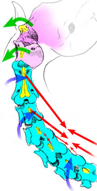 Position is lateral flexion by rotation between 1st and 2nd vertebrae, and counter-rotation in the rest of the neck.
